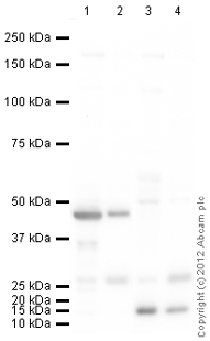 All lanes : Anti-UCP3 antibody (ab125830) at 1 µg/mlLane 1 : Skeletal Muscle (Human) Tissue Lysate - adult normal tissue (ab29330)Lane 2 : Heart (Human) Tissue Lysate - adult normal tissue (ab29431)Lane 3 : Liver (Human) Tissue Lysate - adult normal tissue (ab29889) - (Negative Control)Lane 4 : Kidney (Human) Tissue Lysate - adult normal tissue (ab30203)- (Negative Control)Lysates/proteins at 10 µg per lane.SecondaryGoat Anti-Rabbit IgG H&L (HRP) (ab97051) at 1/10000 dilutiondeveloped using the ECL techniquePerformed under reducing conditions.