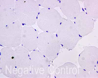 ab172624 showing -ve staining in Human skeletal muscle tissue.