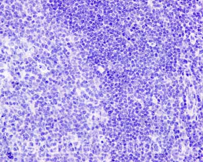 ab172624 showing -ve staining in Human normal tonsil tissue.