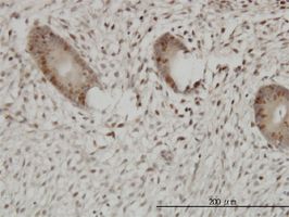 UHRF1 antibody (ab57083) used in immunohistochemistry at 3ug/ml on formalin fixed and paraffin embedded human endometrium.