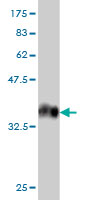 Western blot against tagged recombinant protein immunogen using ab56736 ULK2 antibody at 1ug/ml.