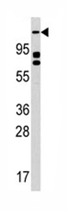 Anti-ULK2 antibody - Aminoterminal end (ab76041) at 1/60 dilution + K562 cell line lysates at 35 µg
