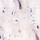 ab76041, at a 1/10 dilution, staining ULK2 in formalin fixed, paraffin embedded human brain tissue by Immunohistochemistry. ab76041 was peroxidase conjugated to the secondary antibody, followed by DAB staining.
