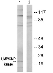 All lanes : Anti-UMP/CMP kinase antibody (ab64934) at 1/500 dilutionLane 1 : Extracts from HeLa cellsLane 2 : Extracts from HeLa cells with immunising peptide at 10 µgLysates/proteins at 30 µg per lane.