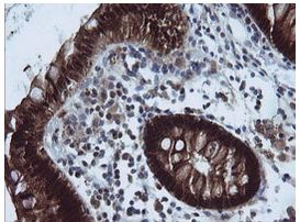 Immunohistochemical analysis of paraffin-embedded Human colon tissue labelling UMP/CMP kinase with ab139355 at 1/150 dilution.