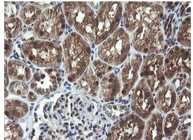 Immunohistochemical analysis of paraffin-embedded Human kidney tissue labelling UMP/CMP kinase with ab139355 at 1/150 dilution.