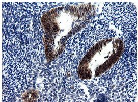 Immunohistochemical analysis of paraffin-embedded Human endometrium tissue labelling UMP/CMP kinase with ab139355 at 1/150 dilution.