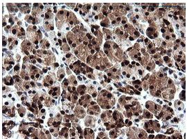 Immunohistochemical analysis of paraffin-embedded Human pancreas tissue labelling UMP/CMP kinase with ab139355 at 1/150 dilution.