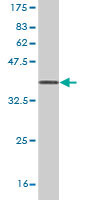 Western blot against tagged recombinant protein immunogen using ab58082 UMPS antibody at 1ug/ml.