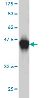 Western blot against tagged recombinant protein immunogen using ab58141 UNC5D antibody at 1ug/ml. 