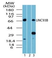 All lanes : Anti-UNC93B antibody (ab72123) at 4 µg/mlLane 1 : Human spleen lysate Lane 2 : Human spleen lysate plus immunising peptideLane 3 : Mouse spleen lysate