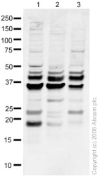 All lanes : Anti-UNG antibody (ab23926) at 1 µg/mlLane 1 : HeLa (Human epithelial carcinoma cell line) whole cell lysate Lane 2 : Jurkat (Human T cell lymphoblast-like cell line) Whole Cell Lysate (ab7899)Lane 3 : HeLa (Human epithelial carcinoma cell line) nuclear lysate Lysates/proteins at 20 µg per lane.SecondaryGoat polyclonal to Rabbit IgG (Alexa Fluor® 680) at 1/10000 dilution