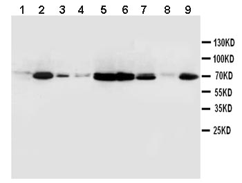 All lanes : Anti-uPA Receptor antibody (ab103791) at 1 µg/mlLane 1 : Human placenta tissue lysateLane 2 : Rat brain tissue lysateLane 3 : Rat thymus tissue lysateLane 4 : Rat heart tissue lysateLane 5 : MCF7 whole cell lysateLane 6 : SMMC whole cell lysateLane 7 : HeLa whole cell lysateLane 8 : Raji whole cell lysateLane 9 : Colo320 whole cell lysate
