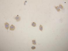 ab103791, at 1µg/ml, staining uPA Receptor in MCF7 cells by Immunocytochemistry.