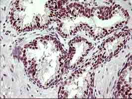Immunohistochemical analysis of paraffin-embedded Human prostate tissue labeling UPRT with ab180382 at 1/150 dilution.