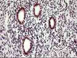 Immunohistochemical analysis of paraffin-embedded Human endometrium tissue labeling UPRT with ab180382 at 1/150 dilution.
