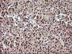 Immunohistochemical analysis of paraffin-embedded Human pancreas tissue labeling UPRT with ab180382 at 1/150 dilution.