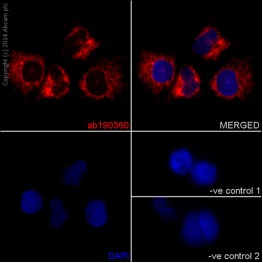 Immunocytochemical analysis of HeLa cells fixed in 4% paraformaldehyde labeling UQCRB with ab190360 at 1/250 dilution and Goat anti rabbit IgG (Alexa Fluor® 555) at 1/200 dilution. Counterstained with DAPI. Negative controls also shown.