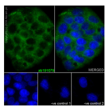 Immunofluorescent analysis of HepG2 cells (4% Paraformaldehyde-fixed; 0.1% tritonX-100 permeabilized) labeling UQCRFS1 with ab191079 at 1/100 dilution followed by Goat anti rabbit IgG (AlexaFluor® 488) secondary at 1/200 dilution and counter-stained with DAPI (blue). Negative controls also shown.