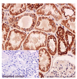 Immunohistochemical analysis of paraffin-embedded Human kidney tissue labeling UQCRFS1 with ab191079 at 1/100 dilution followed by pre-diluted HRP Polymer for Rabbit IgG secondary antibody and counter-stained with Hematoxylin (inset: negative control).