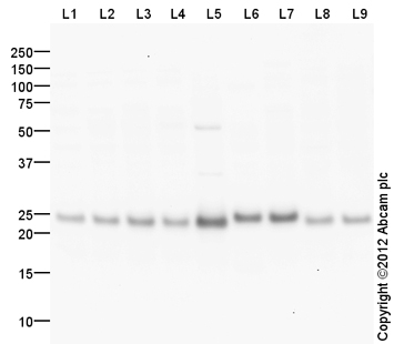 All lanes : Anti-UQCRFS1 antibody (ab131152) at 1 µg/mlLane 1 : HeLa (Human epithelial carcinoma cell line) Whole Cell LysateLane 2 : Hela Whole Cell Lysate - Hydroxyurea Treated (48hr, 2uM)Lane 3 : Hela Whole Cell Lysate - Bleomycin Treated (40U/ml)Lane 4 : Hela Whole Cell Lysate - Staurosporine Treated (48hr, 500nM) Lane 5 : Heart (Human) Tissue Lysate - adult normal tissue (ab29431)Lane 6 : Heart (Mouse) Tissue Lysate Lane 7 : Kidney (Mouse) Tissue LysateLane 8 : THP1 (Human acute monocytic leukemia cell line) Whole Cell LysateLane 9 : Raji (Human Burkitt's lymphoma cell line) Whole Cell LysateLysates/proteins at 10 µg per lane.SecondaryGoat Anti-Rabbit IgG H&L (HRP) (ab97051) at 1/10000 dilutiondeveloped using the ECL techniquePerformed under reducing conditions.