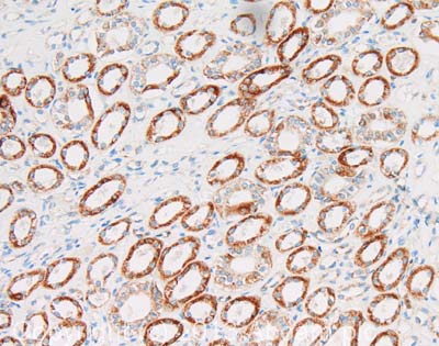 IHC image of UQCRFS1 staining in human kidney formalin fixed paraffin embedded tissue section, performed on a Leica BondTM system using the standard protocol F. The section was pre-treated using heat mediated antigen retrieval with sodium citrate buffer (pH6, epitope retrieval solution 1) for 20 mins. The section was then incubated with ab131152, 1µg/ml, for 15 mins at room temperature and detected using an HRP conjugated compact polymer system. DAB was used as the chromogen. The section was then counterstained with haematoxylin and mounted with DPX. For other IHC staining systems (automated and non-automated) customers should optimize variable parameters such as antigen retrieval conditions, primary antibody concentration and antibody incubation times.