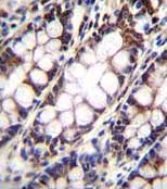 Immunohistochemical analysis of formalin-fixed, paraffin-embedded Human rectum tissue labeling UQCRFS1 with ab170470 at 1/10 dilution, followed by a peroxidase conjugated secondary antibody and DAB staining.