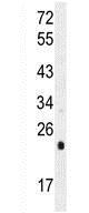 Anti-UQCRFS1 antibody - C-terminal (ab170470) at 1/100 dilution + HeLa cell lysate at 35 µg