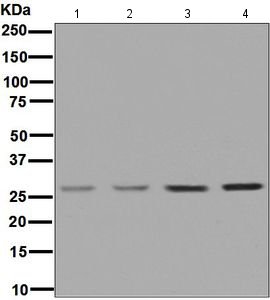 All lanes : Anti-Uridine Phosphorylase 1 antibody [EPR7680] (ab128854) at 1/1000 dilutionLane 1 : 293T cell lysateLane 2 : HeLa cell lysateLane 3 : HCT116 cell lysateLane 4 : Human fetal kidney tissue lysateLysates/proteins at 10 µg per lane.