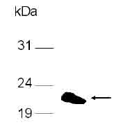 Anti-Urocortin 3 antibody (ab80357) at 1/3000 dilution + E.coli derived protein at 0.4 µg