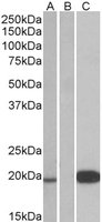 Lanes 1 - 2 :  Anti-Urocortin 3 antibody (ab77433) at 1 µg/mlLane 3 :  Anti DYKDDDDK-Tag antibody at 1/3000 dilutionLane 1 : HEK293 cell lysate overexpressing Urocortin 3 with DYKDDDDK tag at 10 µgLane 2 : Mock-transfected HEK293 cellLane 3 : HEK293 cell lysate overexpressing Urocortin 3 with DYKDDDDK tag at 35 µgdeveloped using the ECL technique