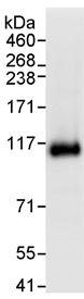 Detection of Human USP10 by Immunoprecipitation in Whole cell lysate from HeLa cells (1 mg for IP, 20% of IP loaded), using ab70895 at 3 µg/mg lysate for IP, and at 1 µg/ml for subsequent Western blot detection.