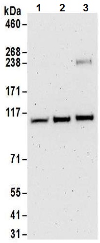 All lanes : Anti-USP10 antibody (ab70895) at 0.1 µg/mlLane 1 : TCMK-1 whole cell lysateLane 2 : 4T1 whole cell lysateLane 3 : CT26.WT whole cell lysateLysates/proteins at 50 µg per lane.developed using the ECL technique