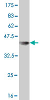 Western blot against tagged recombinant protein immunogen using ab56433 USP10 antibody at 1ug/ml.