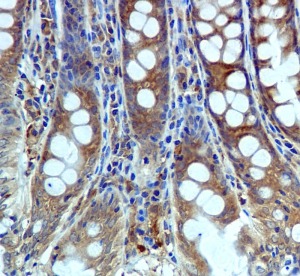 ab109219, at a 1/250 dilution, staining USP10 in paraffin embedded Human colon tissue by Immunohistochemistry.