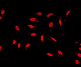 Immunofluorescent staining of USP11 in HeLa cells, using ab109232 at a dilution of 1/100.