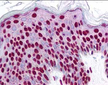 ab51451 at 2.5 µg/ml staining epidermal keratinocytes at 40X.  This image shows strong nuclear staining with localization of the antibody as the precipated red siganl and a hematoxylin purple nuclear counterstain.