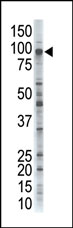 Anti-USP26 antibody - N-terminal (ab71731) at 1/100 dilution + HeLa cell lysate at 12.5 µg