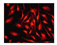 Immunofluorescent staining of Smad3 in HeLa cells using ab52903 at 1/100 dilution.