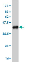 Western blot against tagged recombinant protein immunogen using ab56901 USP3 antibody at 1ug/ml.