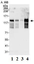 All lanes : Anti-USP37 antibody (ab72199) at 0.04 µg/mlLane 1 : HeLa whole cell lysate at 50 µgLane 2 : HeLa whole cell lysate at 15 µgLane 3 : HeLa whole cell lysate at 5 µgLane 4 : 293T whole cell lysate at 50 µgdeveloped using the ECL technique