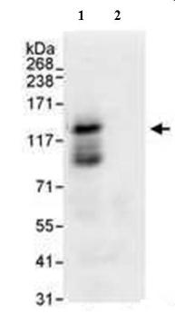 Immunoprecipitation of HeLa whole cell lysate (1mg) using ab72199 at 3µg/mg lysate. 20% of the immunoprecipitate was used for Western blotting and detected using ab72199 at 1µg/ml. Bands were exposed by chemiluminescence with an exposure time of 10 seconds.