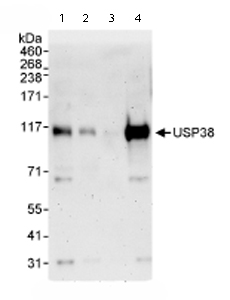 All lanes : Anti-USP38 antibody (ab72244) at 0.1 µg/mlLane 1 : Whole cell lysate from Hela cells at 50 µgLane 2 : Whole cell lysate from Hela cells at 15 µgLane 3 : Whole cell lysate from Hela cells at 5 µgLane 4 : Whole cell lysate from 293T cells at 50 µg