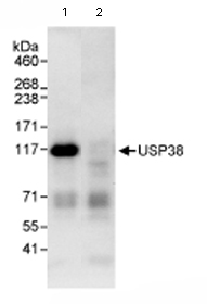 Immunoprecipitation/ Western Blot of USP38. Lane 1: ab72244 at 3µg/mg whole cell lysate. Lane 2: Control IgG. ab72244 at 1µg/ml for WB. Whole cell lysate from Hela cells at 1mg for IP, 20% of IP loaded. Detection:Chemiluminescence with an exposure time of 30 seconds.