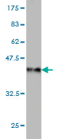 Western blot against tagged recombinant protein immunogen using ab58087 USP4 antibody at 1ug/ml.
