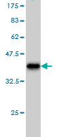 Western blot against tagged recombinant protein immunogen using ab56372 USP5 antibody at 1ug/ml.