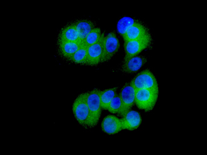 Immunofluorescent analysis of MCF7 cells labeling USP5 with ab154170 at 1/50 dilution.