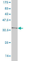 Western blot against tagged recombinant protein immunogen using ab56431 USP6 antibody at 1ug/ml.