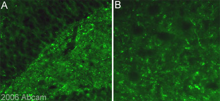 Immuofluorescent staining for USP9X in the rat hippocampus (dentate gyrus) using ab19879 (1/300 = 0.07µg/ml). Image is taken with X10 objective. ab19879 was incubated overnight at RT. Secondary antibody used was anti-rabbit Alexa fluor 488 (1/1000 for 2h at RT). Rats were intracardially perfused with paraformaldehyde 4%, brain tissue was post-fixed overnight in the same fixative, cryoprotected in 20% sucrose and frozen in OCT. 30µm coronal sections were cut on a cryostat for free floating IHC.