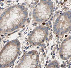 Image courtesy of Human Protein Atlasab26334 staining USP9x in Human stomach. The paraffin embedded human skin tissue was incubated with ab26334 (1/450 dilution) for 30 mins at room temperature. Antigen retrieval was performed by heat induction in citrate buffer pH 6. Ab26334 was tested in a tissue microarray (TMA) containing a wide range of normal and cancer tissues as well as a cell microarray consisting of a range of commonly used, well characterised human cell lines. Further results for this antibody can be found at www.proteinatlas.org